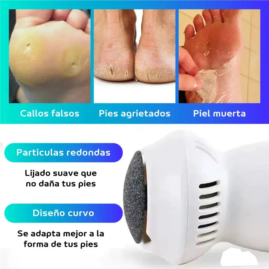 Removedor de callos eléctrico recargable